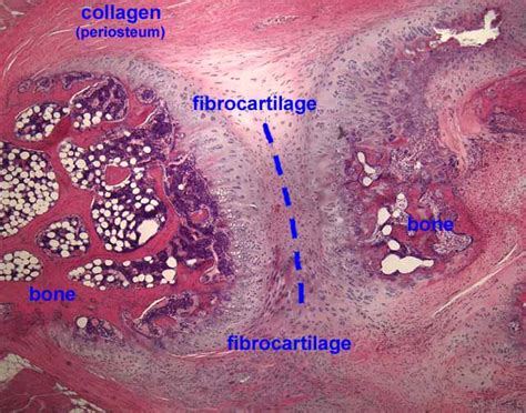 Fibrocartilage Histology