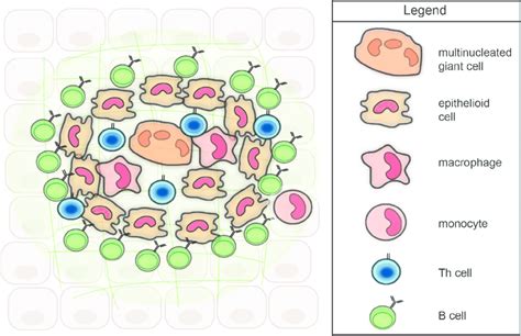 Model of the cellular organization of a non-caseating granuloma ...