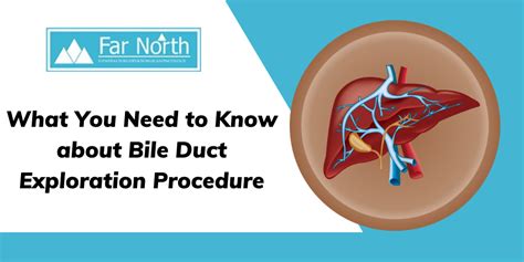 What You Need to Know about Bile Duct Exploration Procedure