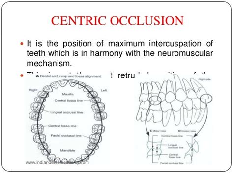 Occlusion