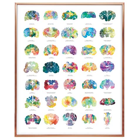 Brain Anatomy Poster 16 X 20 Oversized Wall Art Great Medical Student 0r Veterinarian Gift ...