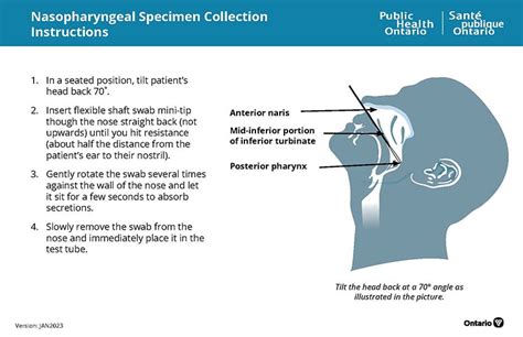 Nasal Swab Collection Procedure