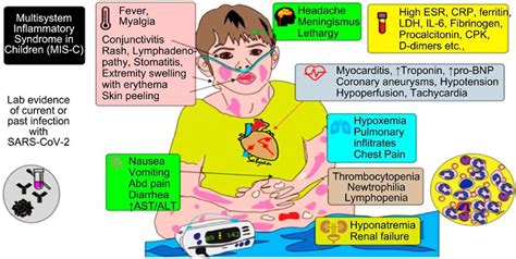 Infographic showing CDC criteria for the diagnosis of MIS-C. | Download ...