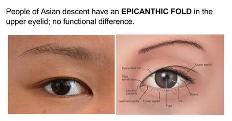 Epicanthal Folds