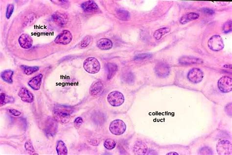 SIU SOM Histology CRR | Loop of henle, Histology slides, Segmentation