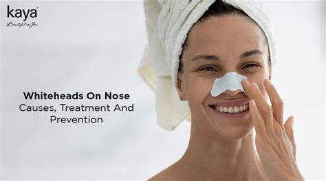 Whiteheads on Nose: Causes, Treatment, Prevention - Blog