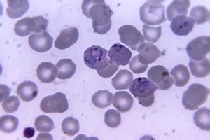 Free picture: micrograph, blood smear, microgametocyte, parasite, plasmodium falciparum