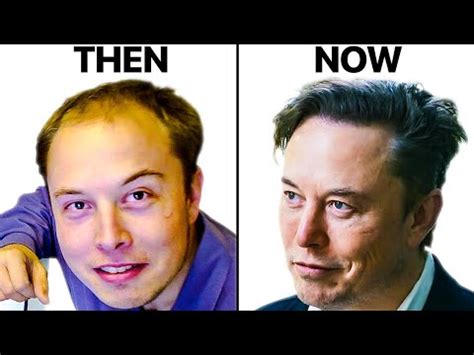 Elon Musk Before & After Hair: Everything You Need To Know!