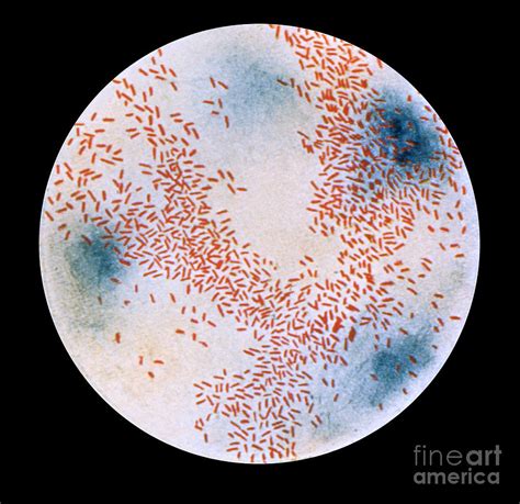 Haemophilus Influenzae Bacteria Photograph by Science Source - Pixels