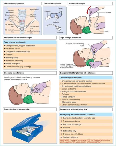 Tracheostomy care | Nurse Key