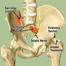 5 Ways to Treat Sacroiliac Joint (SI Joint) Pain