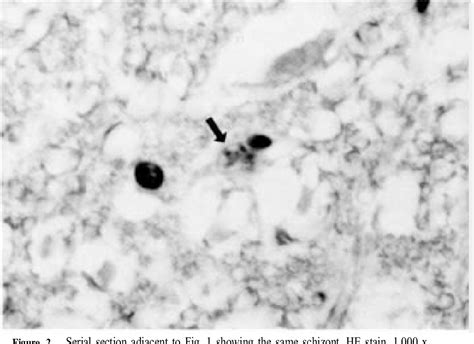 Figure 2 from Immunohistochemical Diagnosis of Protozoan Parasites in Lesions of Equine ...