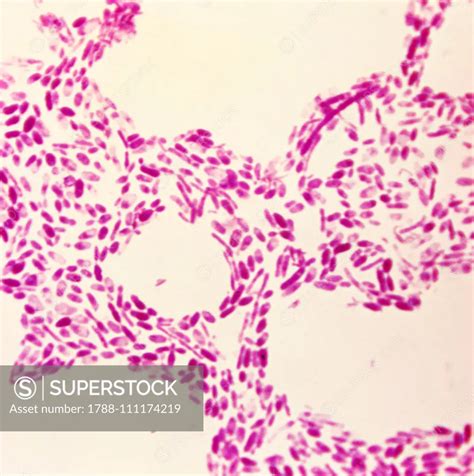 Acetobacter bacteria seen under a microscope with counterstaining, at x670 magnification ...