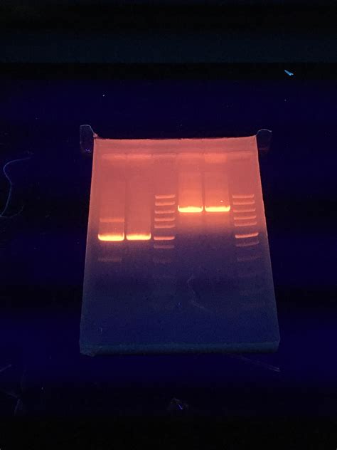 My First Agarose Gel! : r/labrats