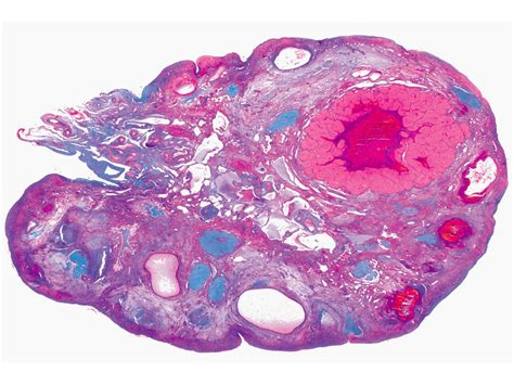 Ovarian Follicles Slide