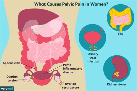 Pelvic Pain: Causes, Other Symptoms, and Treatment