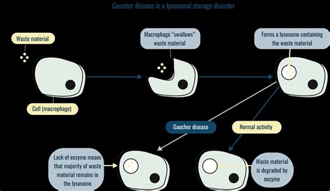 How Type 1 Gaucher Disease Works | Information for patients and families