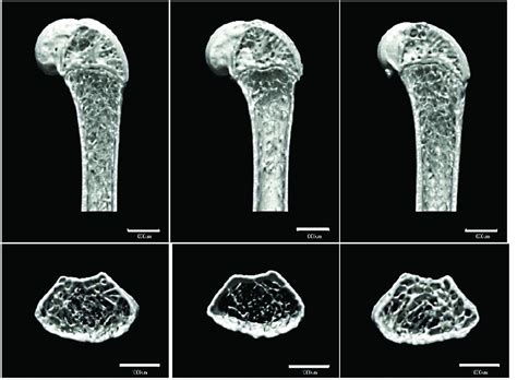 Astronauts may need to jump in space to fight bone loss | Space