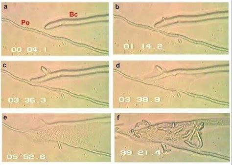 Pythium oligandrum - Alchetron, The Free Social Encyclopedia