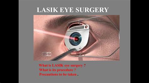 Lasik Eye Surgery - Application of Laser in Medical Science - YouTube