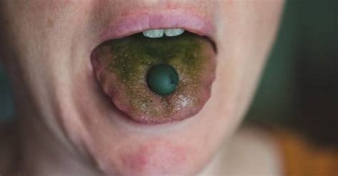 12 Reasons Why Your Tongue Is Green & How To Treat It Safely