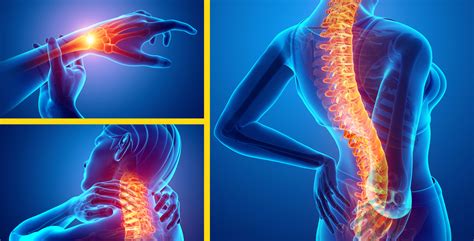 Ergonomics training key to RSI awareness and pain prevention | Workers Health & Safety Centre