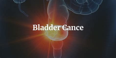 What is bladder cancer? Causes, symptoms, treatment of bladder tumors - INDEX CHINA Medicine