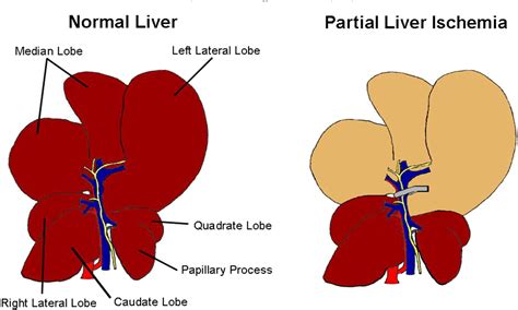 Figure 1 from Mouse model of liver ischemia and reperfusion injury: method for studying reactive ...