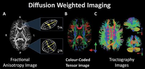 Diffusion weighted imaging refers to a set of magnetic resonance... | Download Scientific Diagram