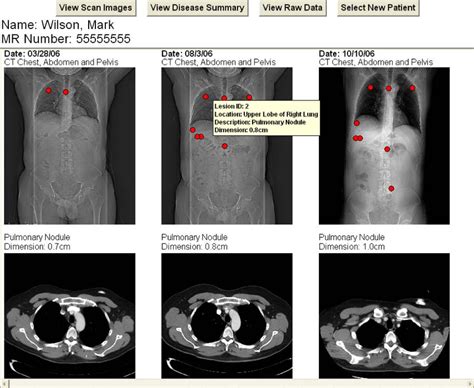 Ct Scan Abdomen Pelvis Anatomy