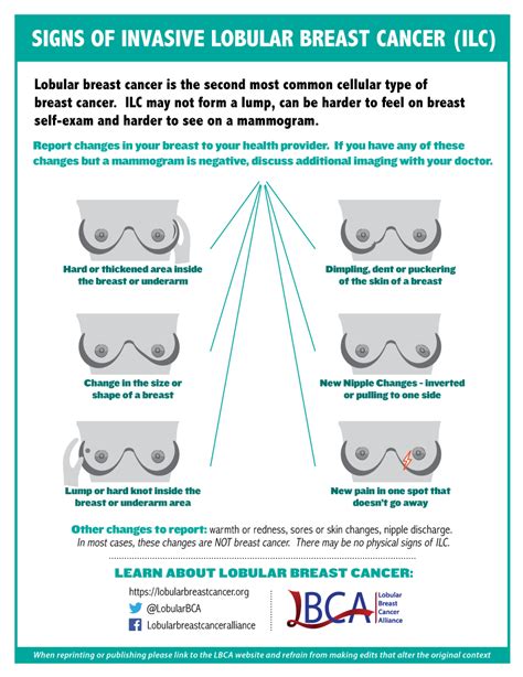 Signs and Symptoms of Lobular Breast Cancer - The Lobular Breast Cancer Alliance