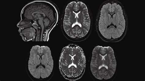 CT vs. MRI: What's the Difference? - Windom Area Health