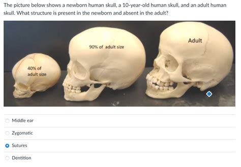 Solved The picture below shows a newborn human skull, a | Chegg.com