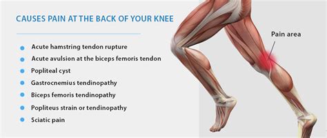 Getting to the Source of Bent Knee Pain - NYDNRehab.com