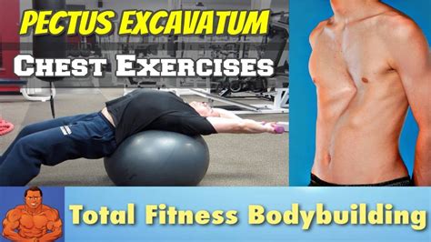 Chest Stretching Exercises for Pectus Excavatum (sunken chest) - YouTube