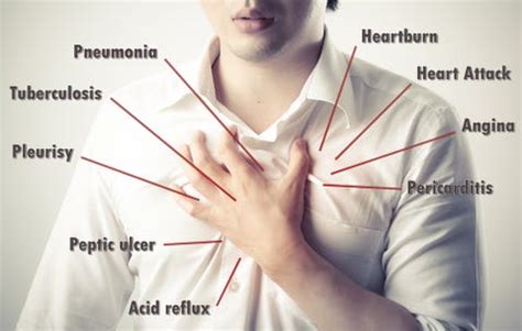 6 Weird Signs You Have Acid Reflux | Prevention