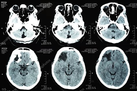 Images from a computerized tomography — Stock Photo © nimon_t #121754494