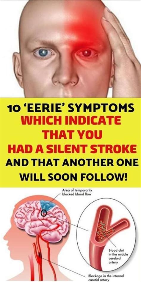 10 ‘Eerie’ Symptoms Which Indicate That You Had A Silent Stroke And ...