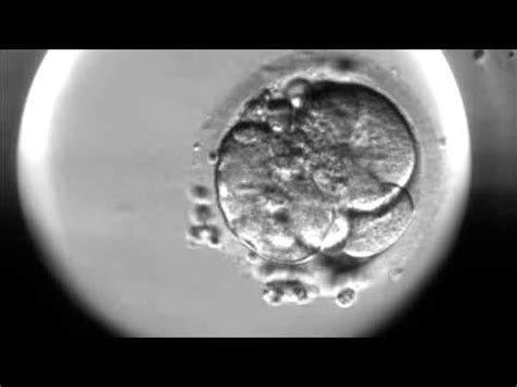 Timelapse of fertilisation of a human egg under the microscope - YouTube