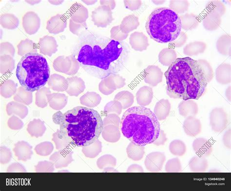 Monocyte Cell (white Blood Cell) Image & Photo | Bigstock