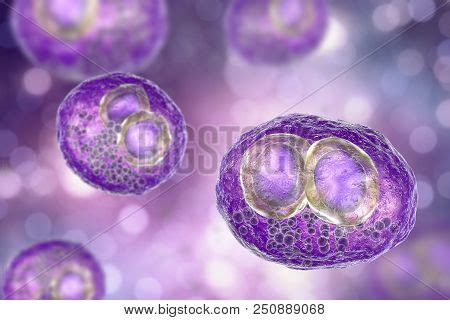 Cytomegalovirus Cmv Image & Photo (Free Trial) | Bigstock