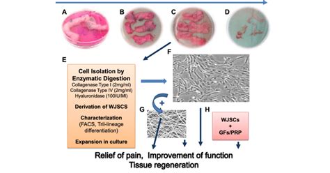 Umbilical cord-Wharton's Jelly stem cells (WJSCs) for cartilage or IVD... | Download Scientific ...