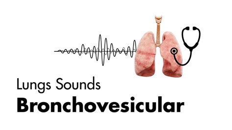 Bronchovesicular Breath Sounds - Lung Sounds - MEDZCOOL - YouTube