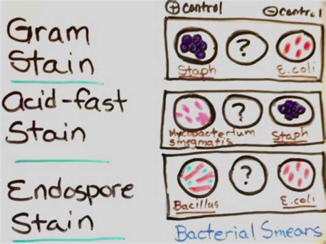 Differential Stains for Identifying Bacteria: Gram, Acid-fast ...