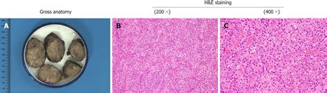 Dendritic Cells Histology