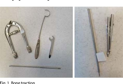 Figure 1 from History of osteosynthesis in the Department of ...