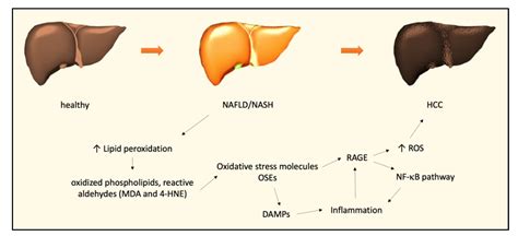 Biomedicines | Free Full-Text | The Role of Oxidative Stress in NAFLD ...