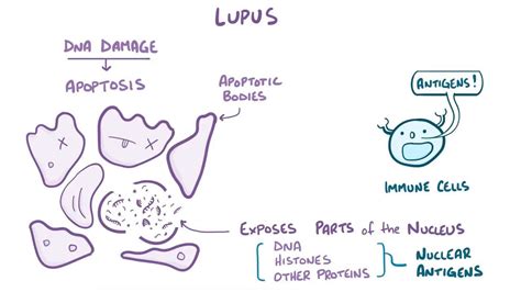 Lupus nephritis: Video, Anatomy, Definition & Function | Osmosis