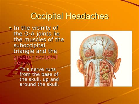 PPT - Occipital Headaches (Occipital Neuralgia) PowerPoint Presentation - ID:3208705