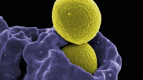 Staphylococcus Aureus